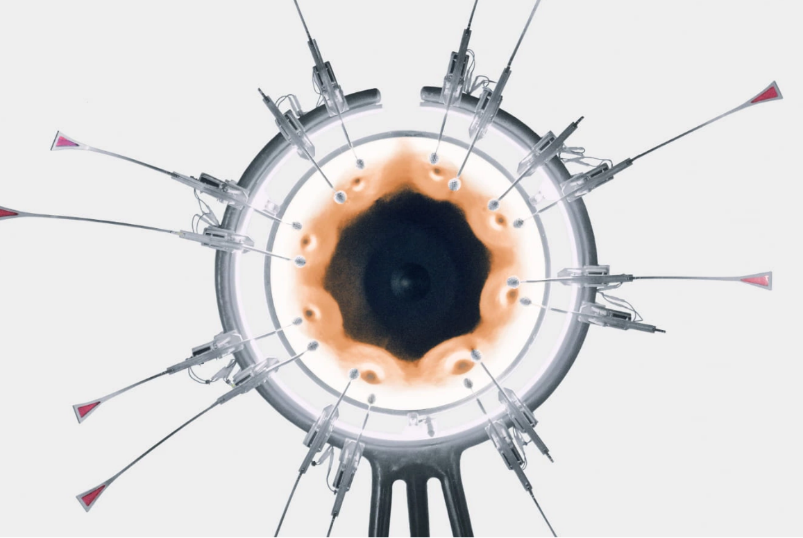 グローバル株式ポートフォリオにおけるアクティブ運用としてのテーマ株式