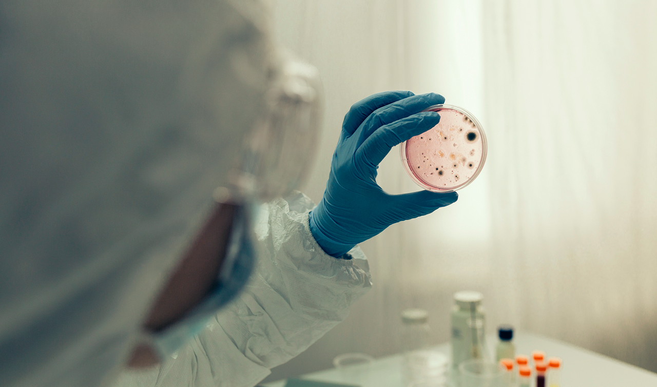 Unrecognizable scientist examining virus in petri dish in a laboratory